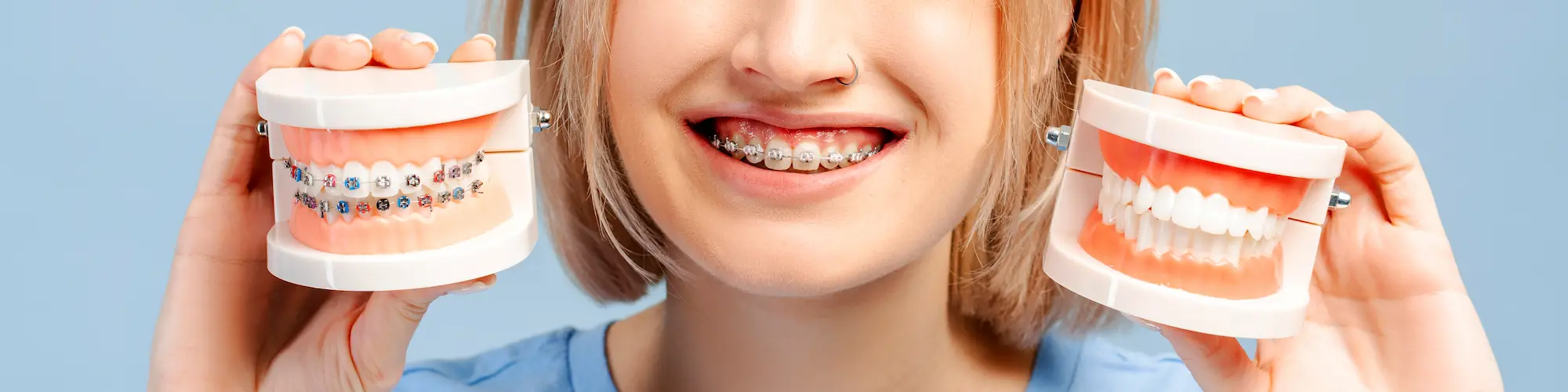 Ortodonzia header - Studio dentistico Feroci Napoli